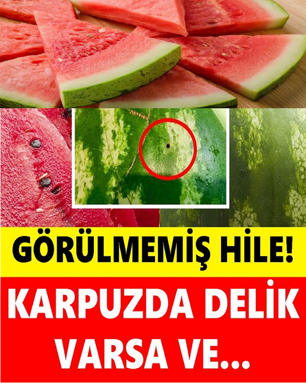 Karpuzda Görülmemiş Hile: Karpuz Alırken Mutlaka Buna Dikkat Edin