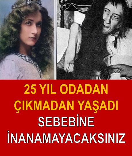 25 Yıl Boyunca Odadan Çıkmadı Son Hali İse Şoke Etti