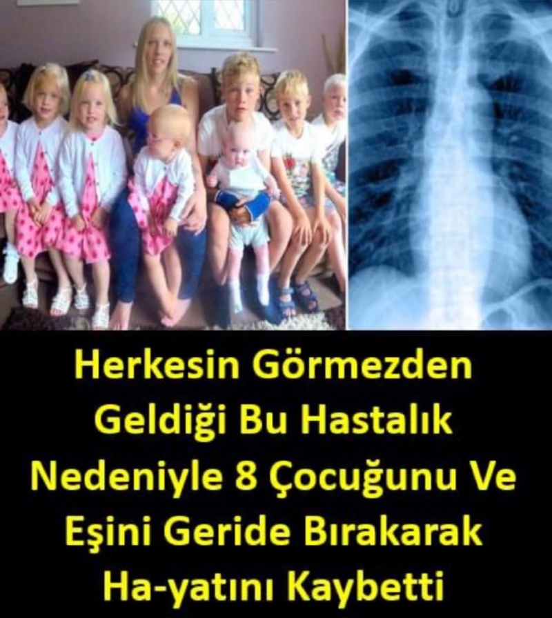 Aman Dikkat! Genç Kadın Arkasında 8 Çocuk Bırakarak, Herkesin Göz Ardı Ettiği Bu Hastalık Yüzünden Hayatını Kaybetti