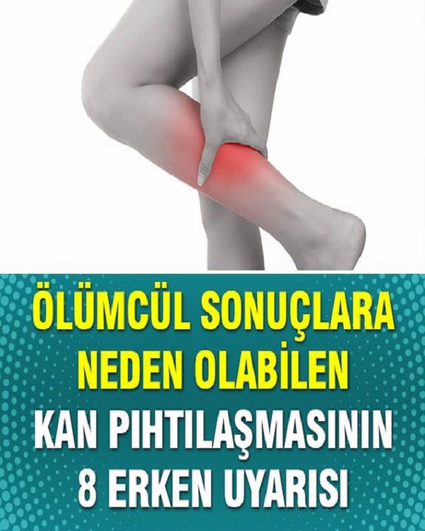 Kan Pıhtılaşmasının 8 Erken Uyarısı
