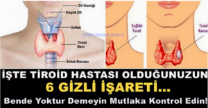 İşte Tiroid Hastası Olduğunuzun 6 Gizli İşareti