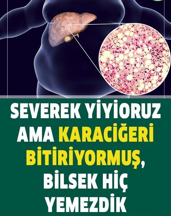 Severek Yiyoruz Ama Karaciğeri Bitiriyor muş?