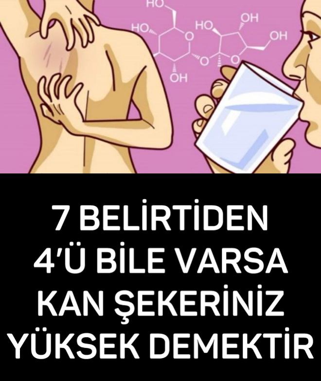 Bu 7 Belirtinin 4’ü Sizde de Varsa Kan Şekeriniz Yüksek Demektir