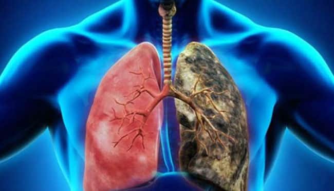 Saraçoğlu Önerdi: Akciğer Kanserine Karşı Mutlaka Tüketilmeli!