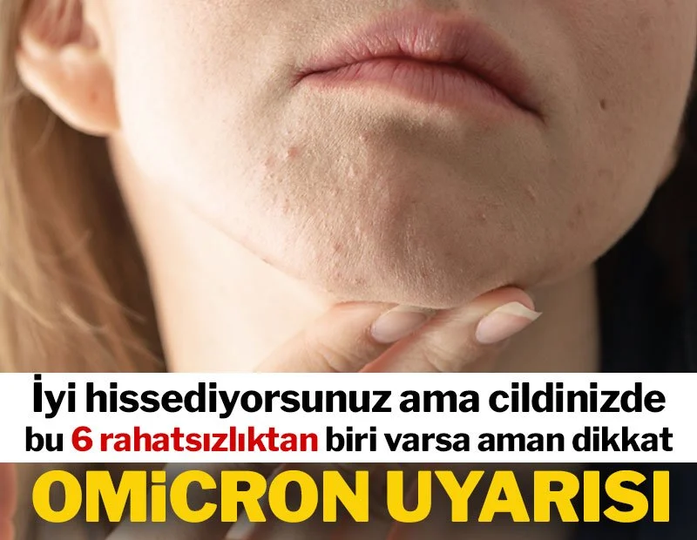 Uzmanlar uyardı: İyi hissediyorsanız ama cildinizde bu belirtiler varsa Omicron olabilir