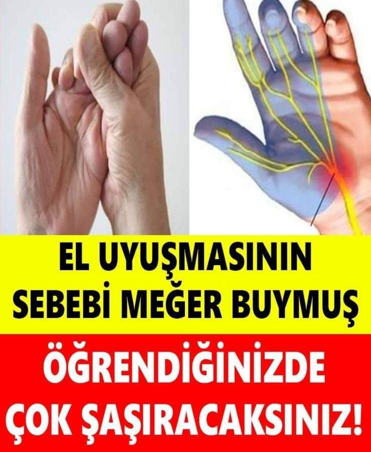 Elleri Uyuşanlar Dikkat! El Uyuşmasının Asıl Sebebi Buymuş