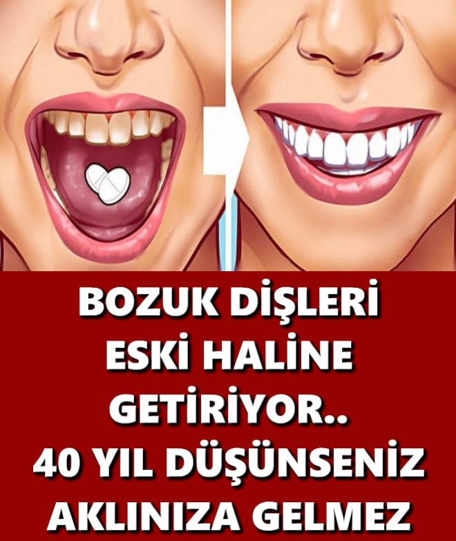 BOZUK DİŞLERİ ESKİ HALİNE GETİRİYOR, 40 YIL DÜŞÜNSENİZ AKLINIZA GELMEZ