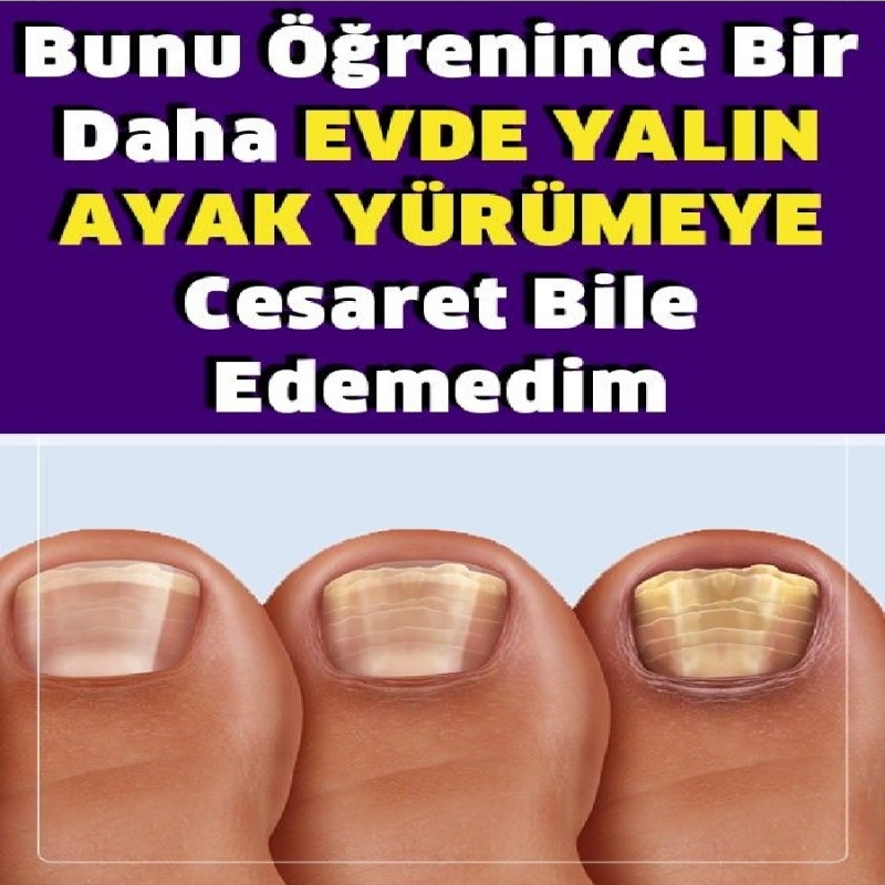 Evde Asla Yalın Ayak Yürümemelisiniz Çünkü