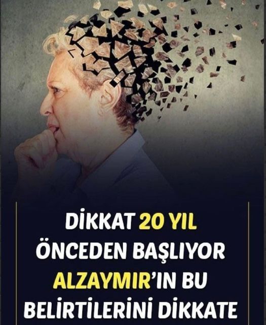 Alzheimer (Alzaymır) Belirtileri 20 Yıl Önceden Başlıyor