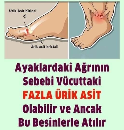 AYAKLARDA Kİ AĞRININ NEDENİ BU YÜZDEN MİŞ?