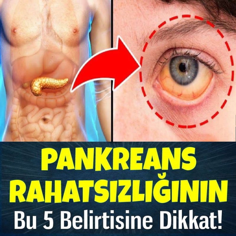 Pankreasınızın Sorunlu Olduğunu Gösteren Belirti