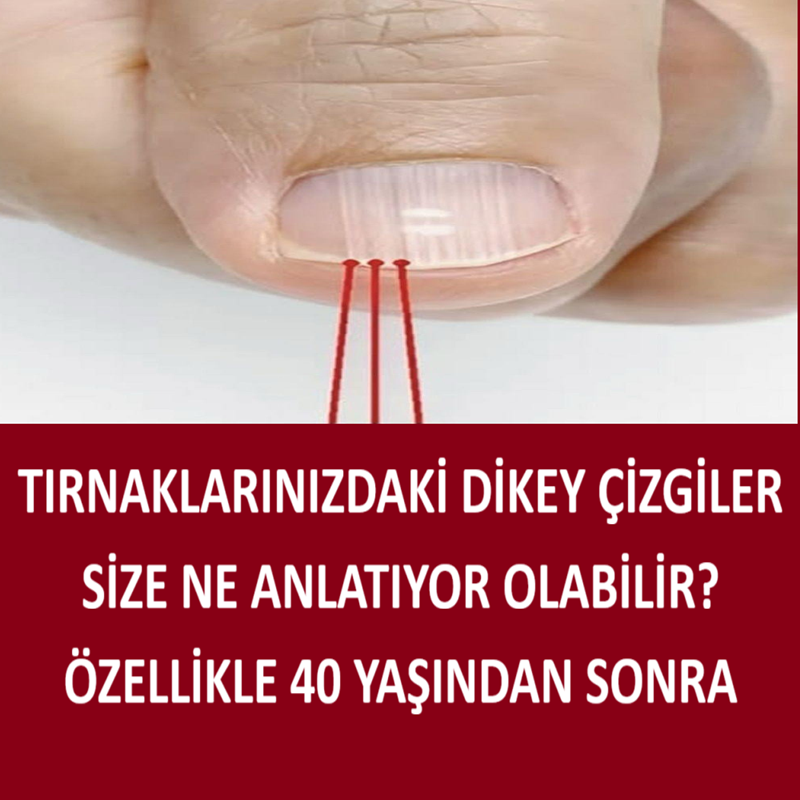 40 Yaşından Sonra Tırnağınızda Bu Çizgiler Varsa, Bu Açık Bir İşaretti