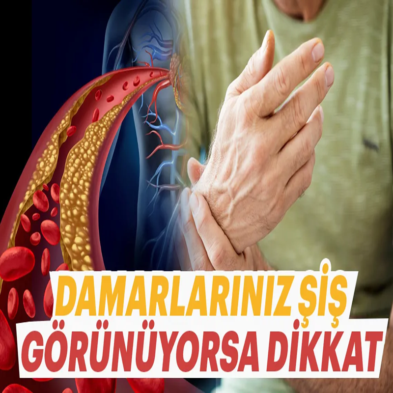Görünür damarların varsa dikkat!