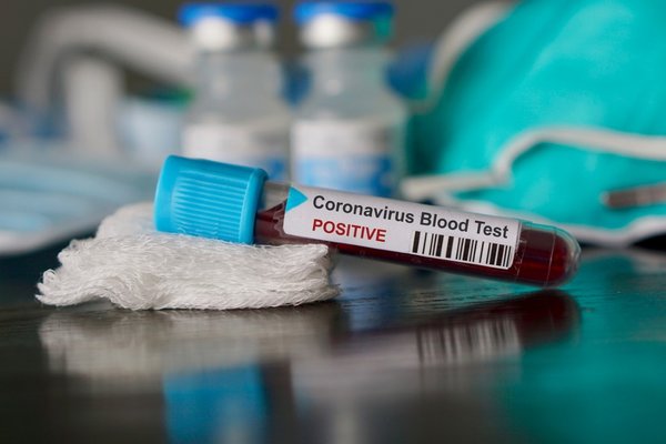 Çinli uzman'dan korkutan açıklama! Corona virüsün kuluçka süresi uzadı