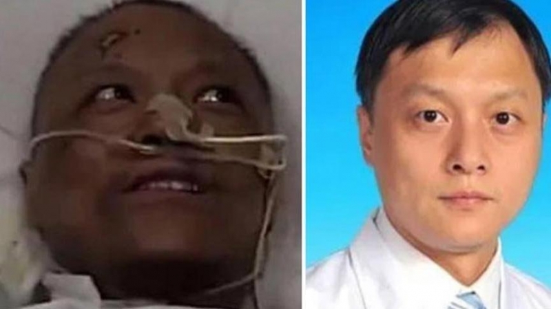 Corona Virüsünü Atlatan Çinli doktorun değişimi şoke etmişti… Bilim Kurulu Üyesi’nden açıklama