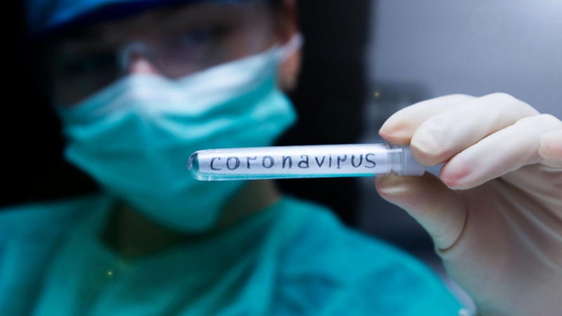 Coronavirüs ve Toplumsal Kaos
