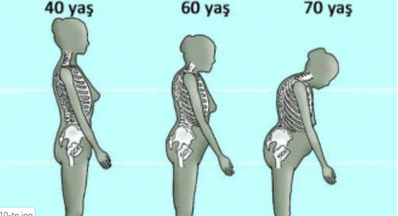 KEMİK ERİMESİNE KARŞI, DOĞAL BİR ÇÖZÜM…