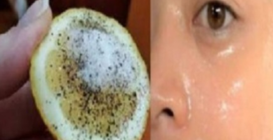 Siyah Noktalardan ve Ölü Deriden Kurtulmak Artık Çok Kolay Mucizevi Limon Yöntemini Denediniz mi ?