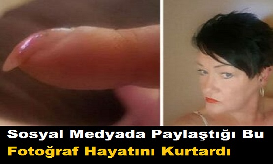 Sosyal Medyada Paylaştığı Bu Fotoğraf Hayatını Kurtardı