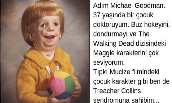 Suratını Gören Herkes Onunla Dalga Geçti, Yapılanları Gururuna Yediremeyip iki Kez İntihara Kalkıştı