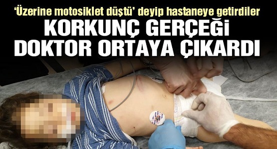 Üzerine Motor Düştü Denilip Hastaneye Kaldırılan 3 Yaşındaki Çocukla İlgili Gerçek, Kan Dondurdu