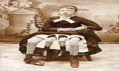 1868’de dünyaya gelen J. Myrtle Corbin, doğuştan 4 ayaklıydı