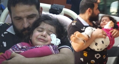 3 Yaşındaki Çocuk, Okuldan Eve Gelen Ablasının Çantasından Aldığı Yapıştırıcı İle Gözlerini Yapıştırdı