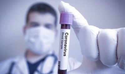 9 Yaş altında görülmeyen corona virüs 3 yaşındaki bir çocukta tespit edildi