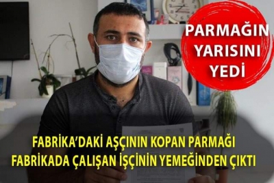 Akıl Almaz Olay: Aşçının Yemek Yaparken Kestiği Parmağı, İşçinin Yemeğinden Çıktı. 