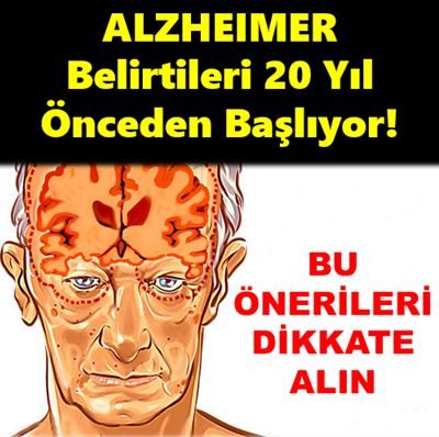 Alzheimer’i bu belirtiler ele veriyor