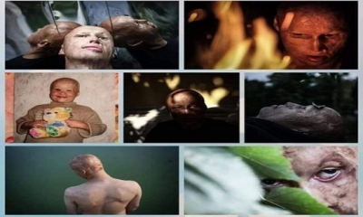 ANKA KUŞU: BABASI TARAFINDAN YANAN SOBAYA ATILAN LYOSHA’NIN HİKAYESİ