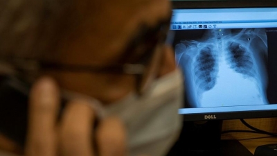 Ben Gencim, Hasta Değilim, Bana Bir Şey Olmaz Diyenlerden misiniz?