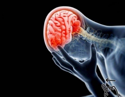 Beyin hasarına neden olan 7 etken