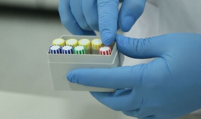 Brezilya'da Corona Virüsü İlaç Testi Denekleri Öldü