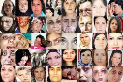 BU FOTOĞRAFA İYİ BAKIN