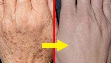 Bu Karışım Sayesinde Tüm Kırışıklıklardan Kurtulun