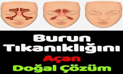 BURUN TIKANIKLIĞINA EN DOĞAL ÇÖZÜM NEDİR? NE İYİ GELİR...