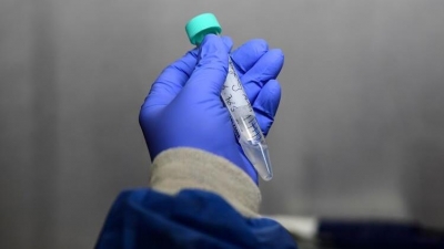 Çin'de Başlayan Yeni Salgın, Tüm Dünyayı Korkutuyor