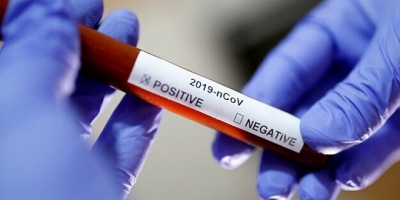 Çinli bilim adamı corona virüsü kabusunun biteceği tarihi açıkladı