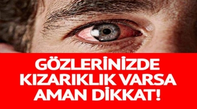 Corona Virüsü Belirtilerine Bir Yenisi Daha Eklendi. Göz Kızarıklığınız Varsa Dikkat! 