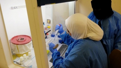 Corona virüsünde heyecanlandıran Gelişme: 17 yıl önceki hastadan coronanın çaresini buldular