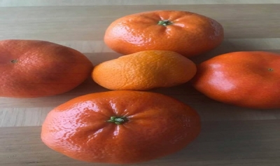 Dikkat Lösemi 1 YAŞIN ALTINA İNDİ: Neden mi? İşte Bu Yüzden