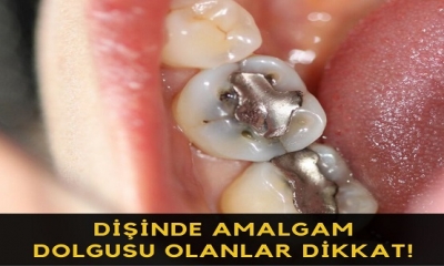 DİŞİNDE DOLGUSU OLANLAR DİKKAT!