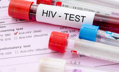 'HIV'de en çok artış olan ülke Türkiye'