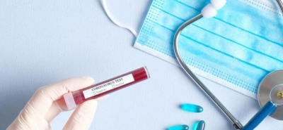 İl Sağlık Müdürlüğünden Test Yaptıran Vatandaşlara Hayati Uyarı