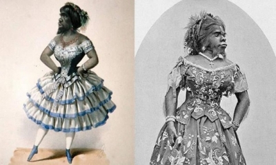 Julia Pastrana Hypertrichosis denilen genetik bozukluğa sahip bu kadının vücudu aşırı uzun siyah kıllarla kaplıdır.