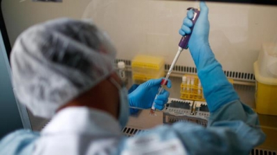 Korona bitmeden bir farklı virüs daha bulundu!