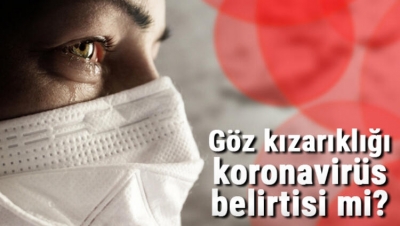 Koronavirüste bu belirtiye dikkat! 