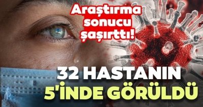 Koronayla İlgili Araştırma Yine Şoke Etti