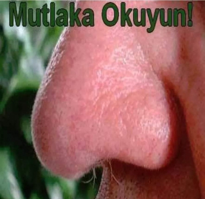 MUTLAKA OKUMALISINIZ: BURNUNDAN KIL ALDIRTMAYANLARIN BAŞI ÇOK AĞRIYABİLİR .